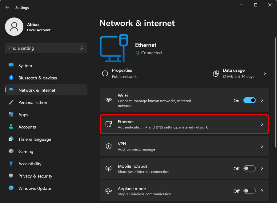 Weisen Sie eine statische IP-Adresse zu
