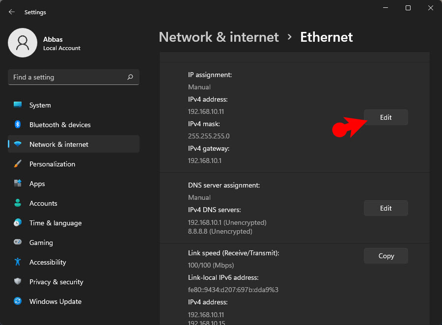 Weisen Sie eine statische IP-Adresse zu