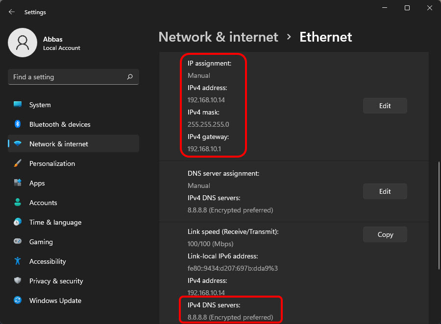 Weisen Sie eine statische IP-Adresse zu